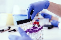 Bilans biologiques préventifs